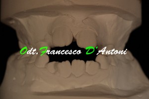 ortodonzia-roma-laboratorio-odontotecnico-d'antoni